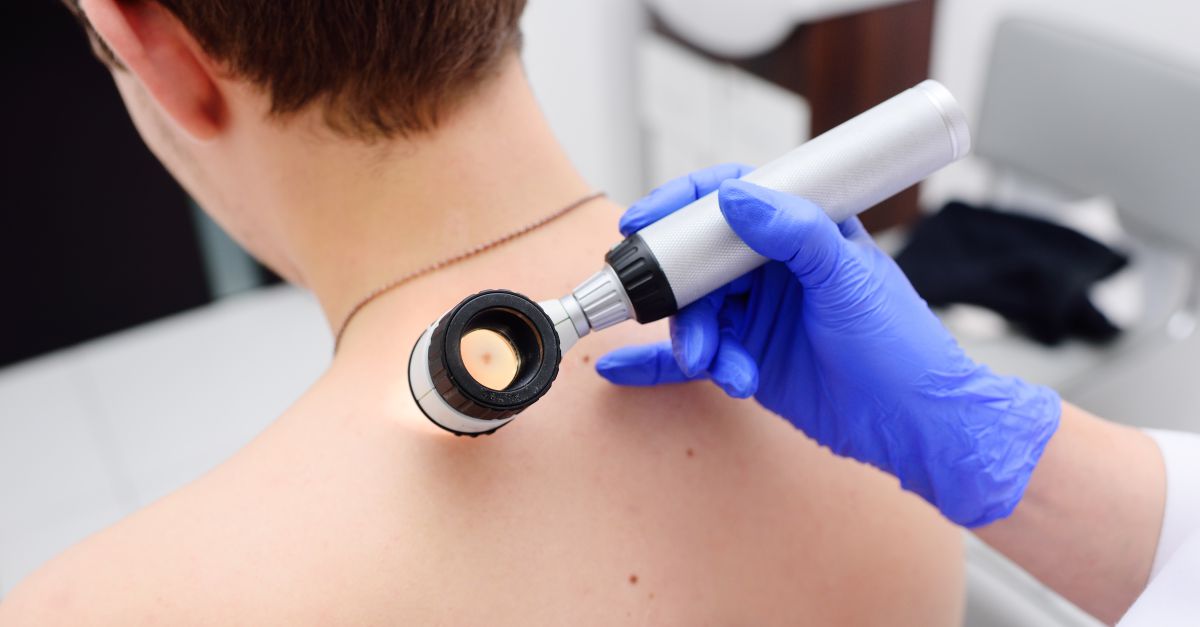 Importanța dermatoscopiei în examinarea pielii