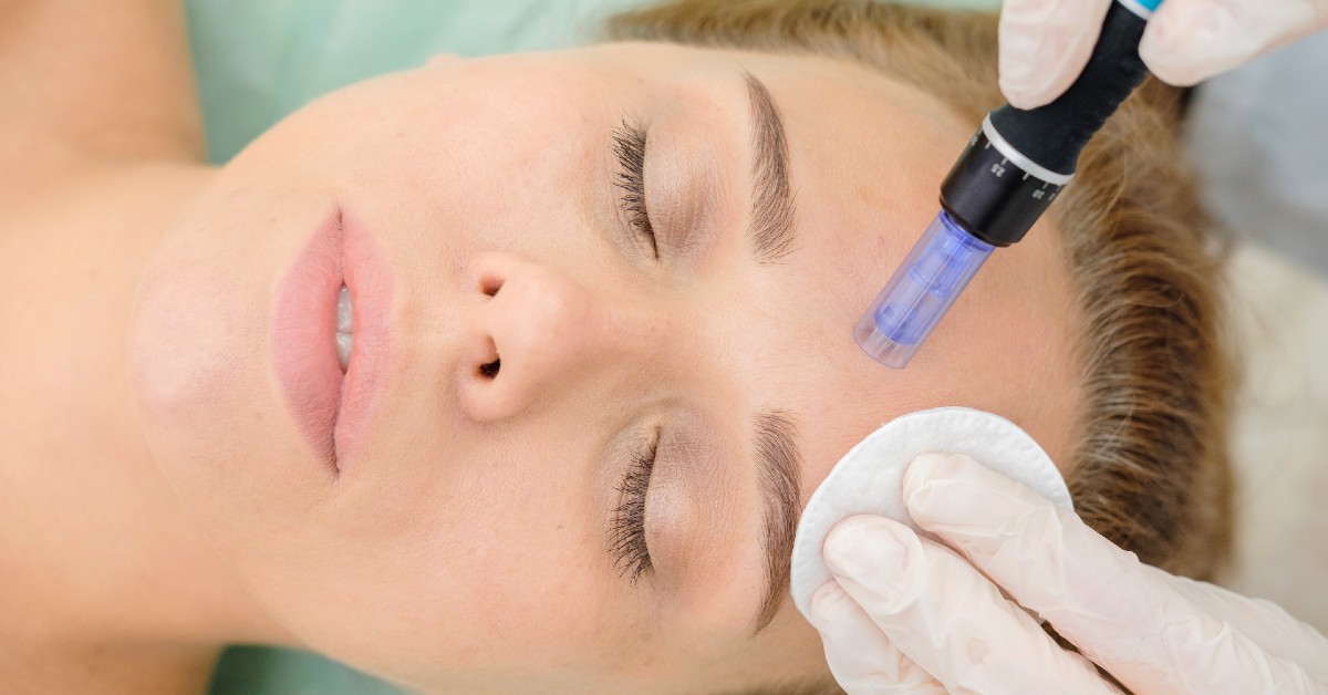 Femeie la un tratament de mezoterapie facială