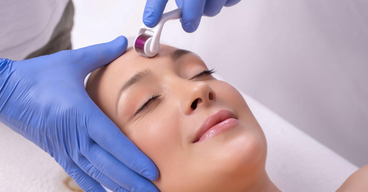Tratament facial cu microneedling