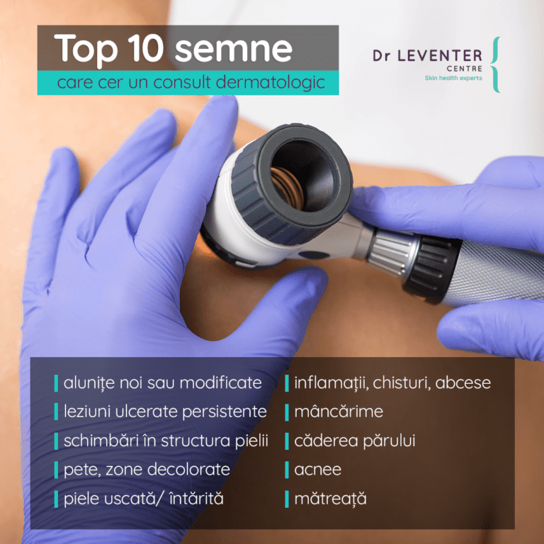top 10 semne care cer un consult dermatologic | Dr. Leventer Centre