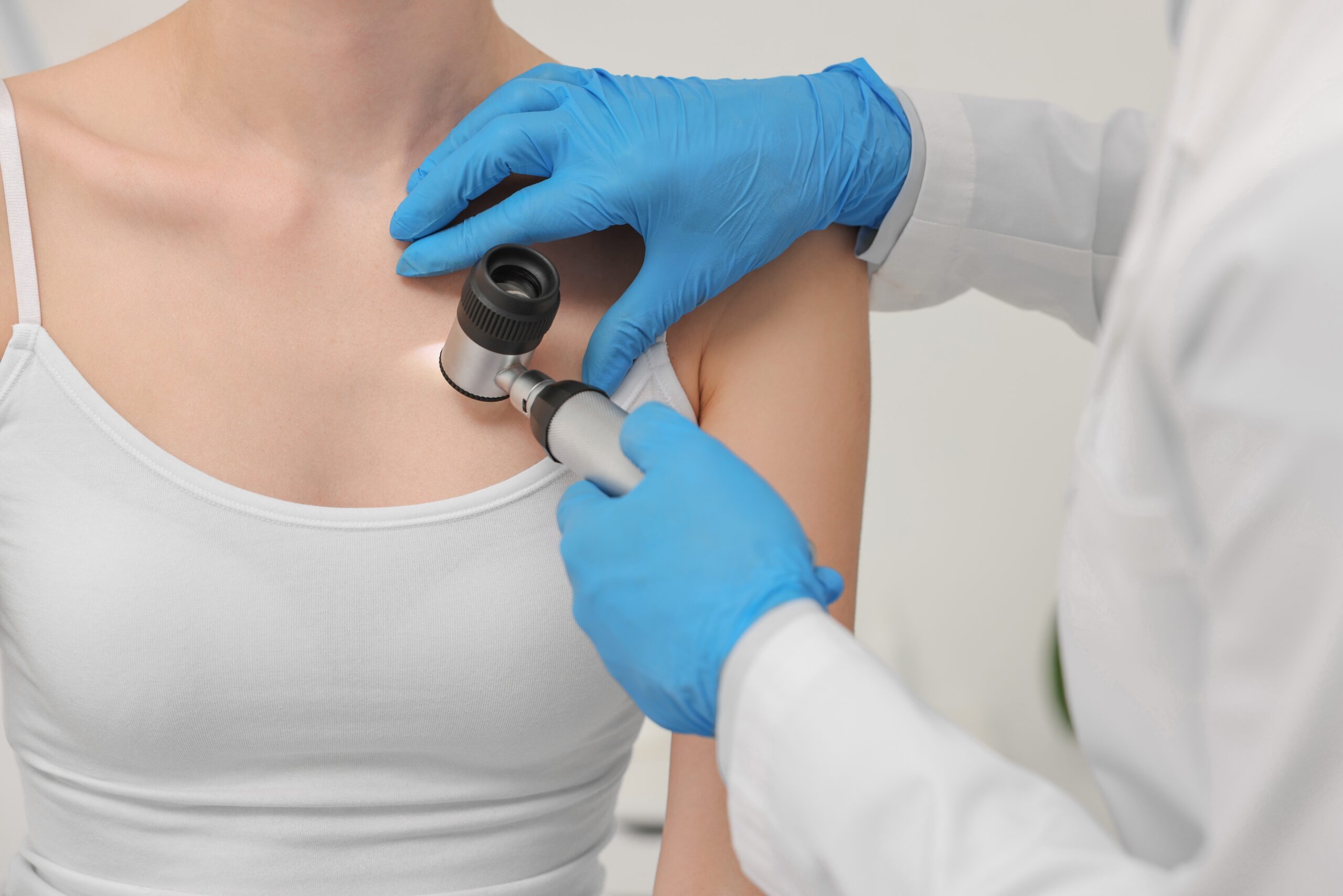 Dermatoscopie pentru verificarea alunițelor